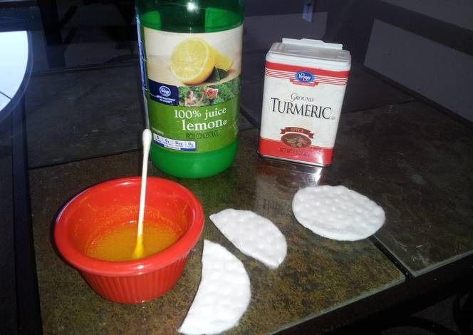 Resep Under the eye dark circle treatment Resep Under the eye dark circle treatment