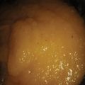 Cooksnap dari santii untuk resep Selai Nanas untuk Olesan Roti