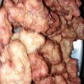 El cooksnap de Alicia Rodriguez cuando hizo Buñuelos de lechuga y cebolla.