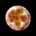 Nutan Shah's cooksnap of when they made Healthy Broccoli Paneer Kabab.