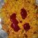 mellssa का कुकस्नैप जब उन्होंने जैन स्टाइल पोहा (jain style poha recipe in Hindi) बनाया था।