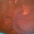 El cooksnap de Maria Elvia Balderas Suarez cuando hizo Mole Casero.