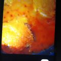 El cooksnap de /María Vergara Olea cuando hizo Bonito con tomate 🐟🐟🐟.