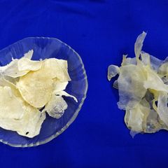 A picture of Potato chips.