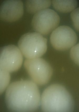 A picture of Chena rasgulla.