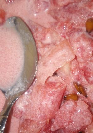A picture of Watermelon with milk.