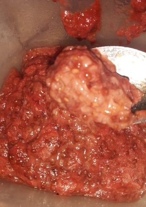 Una foto de Mermelada de frutilla