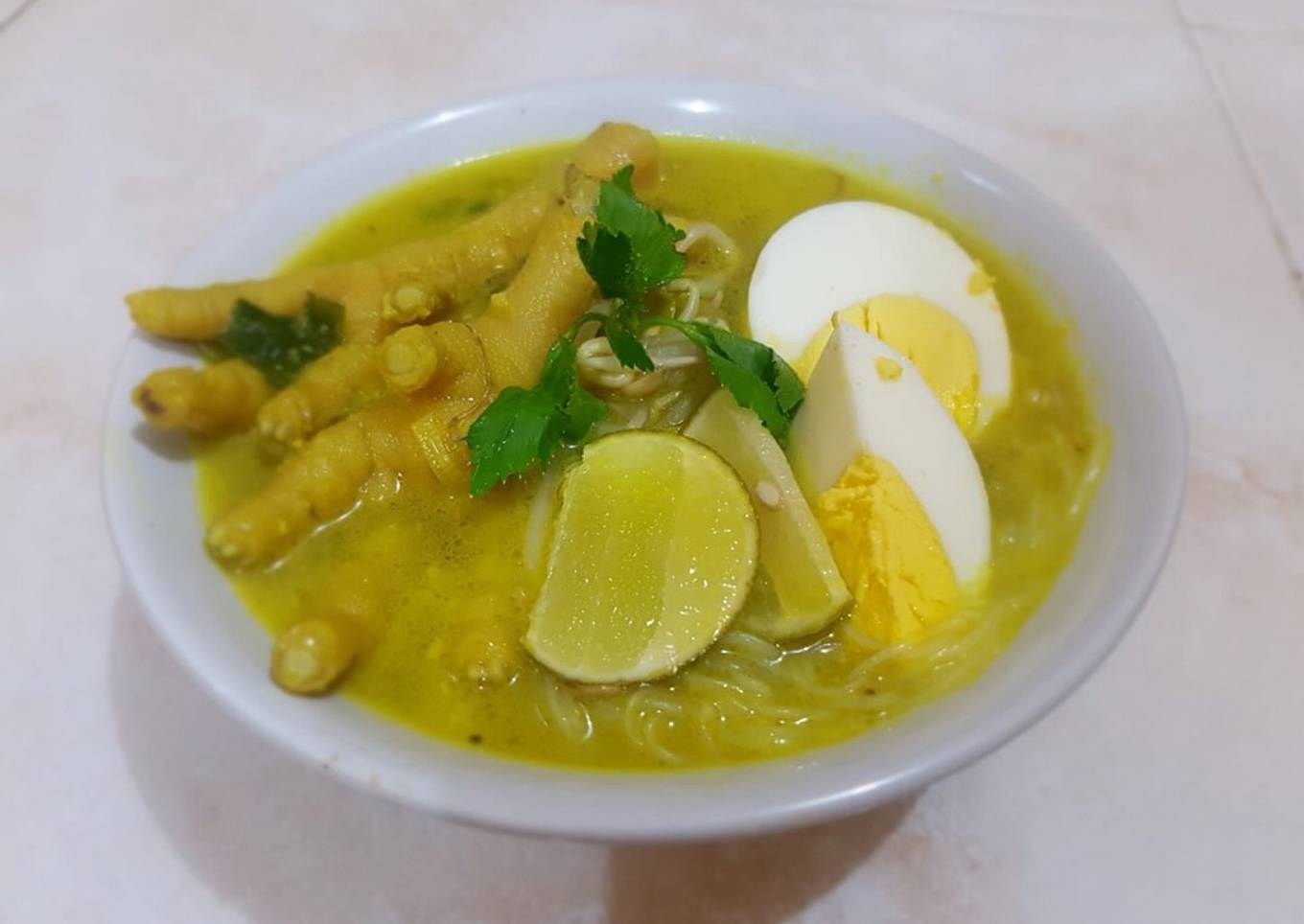 Soto Ceker