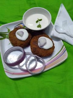 আলু মালাই কাটলেট (aloo malai cutlet recipe in Bengali) রেসিপির প্রধান ছবি