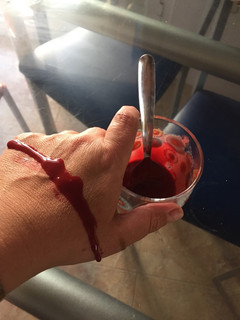 Una foto de Sangre casera