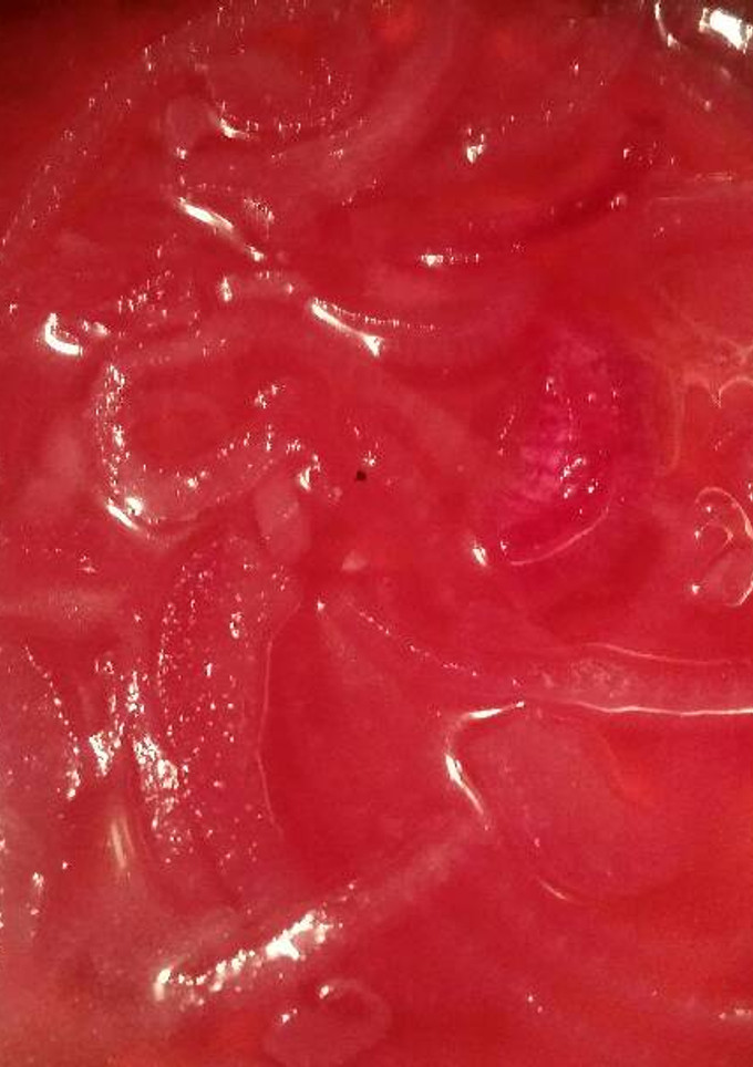 A picture of Quick Pickled Red Onions.
