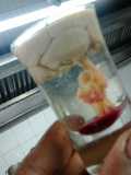 brain hemorrhage