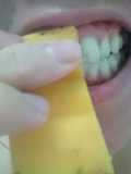 Whiten Teeth With Banana Peel A Natural Remedy