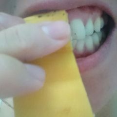 A picture of Whiten Teeth With Banana Peel A Natural Remedy.