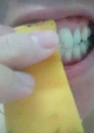 A picture of Whiten Teeth With Banana Peel A Natural Remedy.