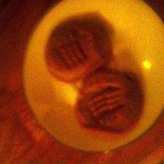 A picture of Easy peanut butter cookies.