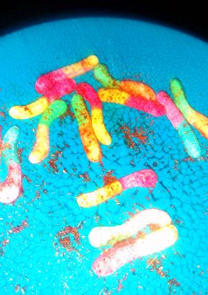 A picture of Mexican Sour Gummi Worms.