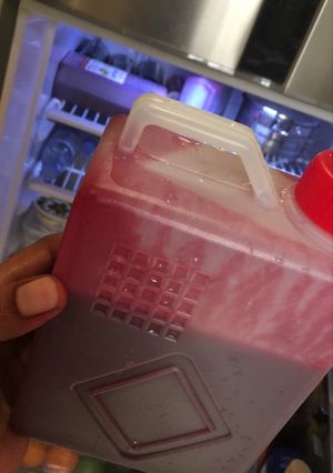 صورة لوصفة بنجر صحي