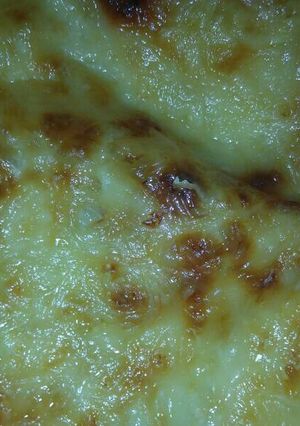 Una foto de Coliflor con bechamel