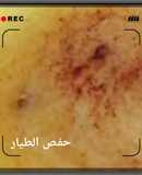 مامونيه