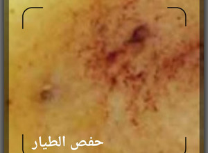 صورة لوصفة مامونيه