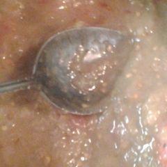 A picture of Eggplant mash.