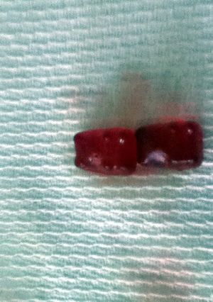 A picture of Giant Gummi Bears.