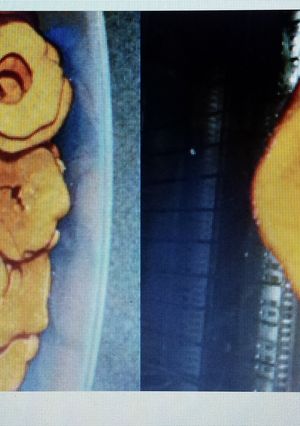 A picture of Apple chips.