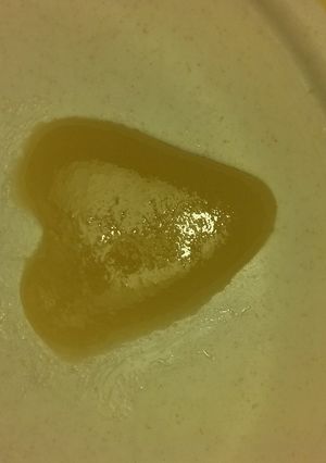A picture of Chapped Lips Remedy.