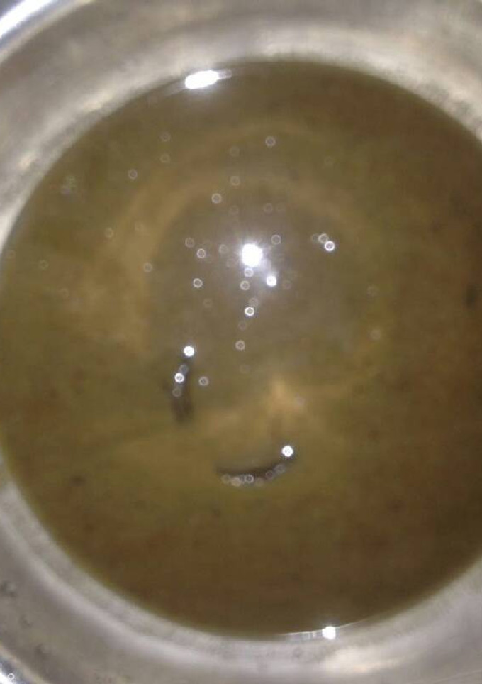 Una foto de Consomé de habichuelas negras para la anemia
