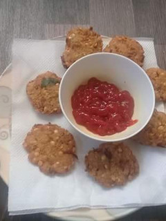 A picture of Chana Dal vada.