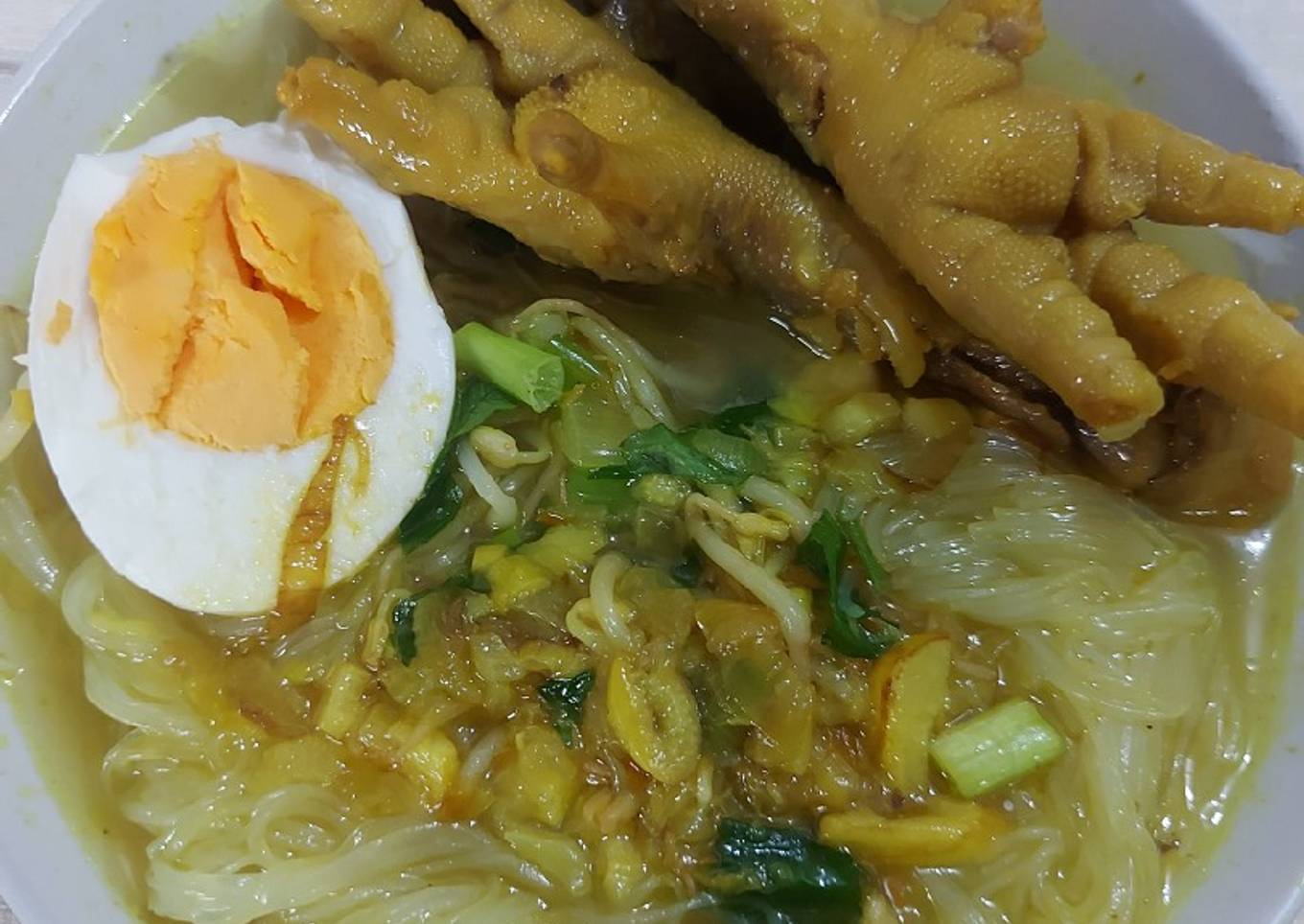 Soto Ceker