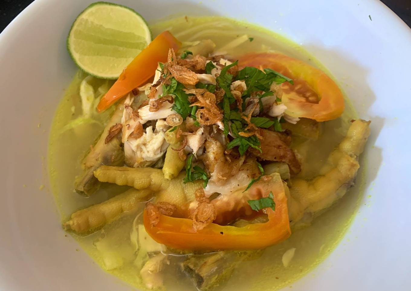 Soto Ceker
