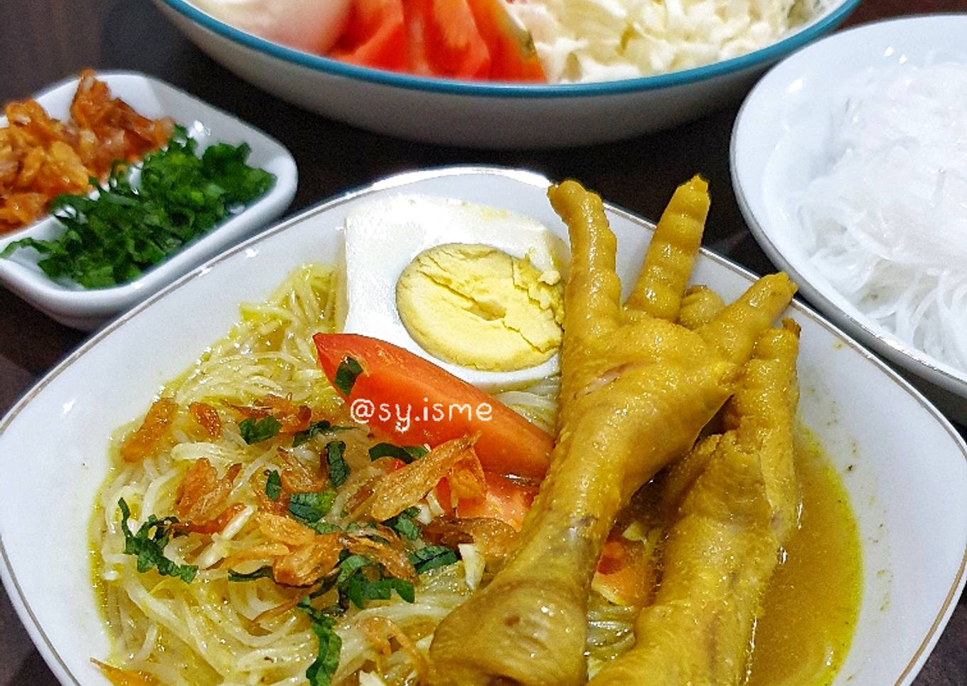 Soto Ceker