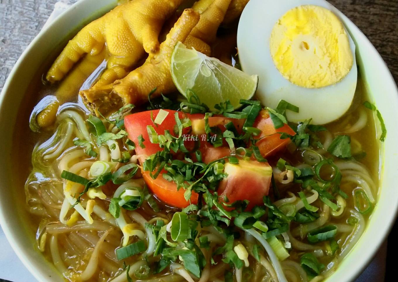 Soto Ceker