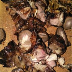 A picture of Kidney choma.