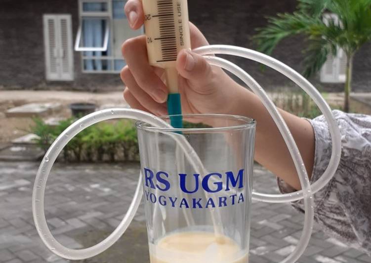 🥛Sonde Tinggi Kalori Tinggi Protein (TKTP)