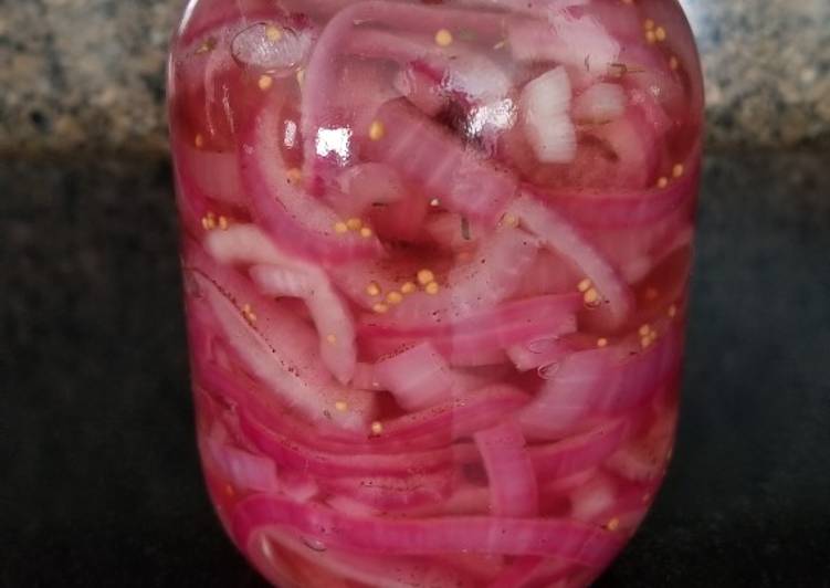 Step-by-Step Guide to Make Ultimate Super Easy Pickled Red Onions