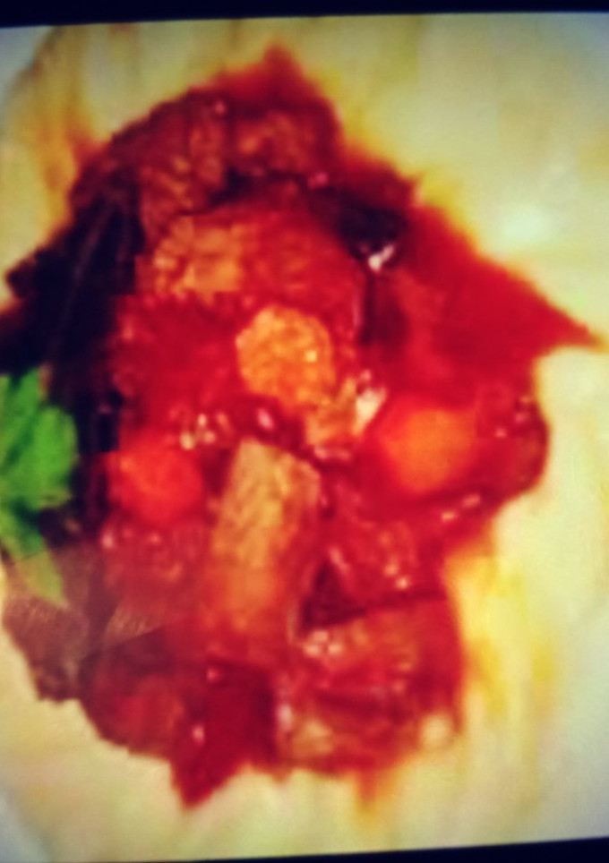 صورة لوصفة لابيري