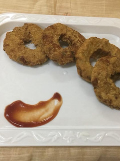 ஊருளைகிழங்கு சிக்கன் டோனட் செய்முறை முக்கிய புகைப்படம்