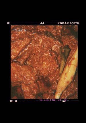 Foto resep Rendang daging sapi