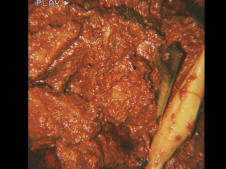 Cara Memasak Rendang daging sapi Praktis