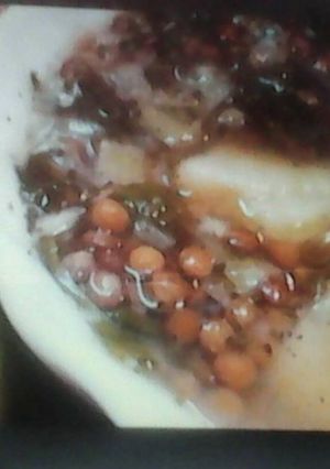 صورة لوصفة عدس بحامض