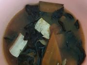 A picture of ear fungus