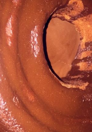 صورة لوصفة الكيك 🍩