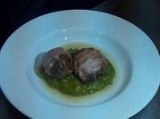 A picture of kidney and liver