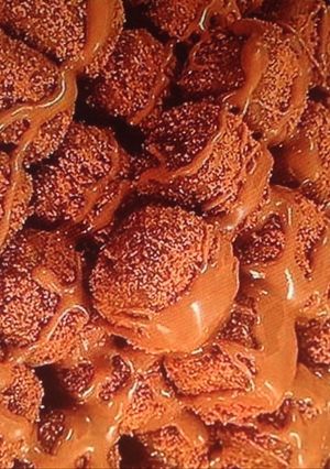 صورة لوصفة تمرية اللوتس