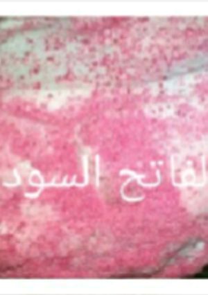 صورة لوصفة كيكه حلوه