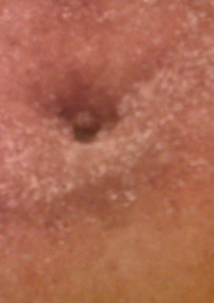 Una foto de Rodajas de manzana rebozadas