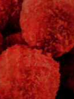 Una foto de Croquetas de pulpo